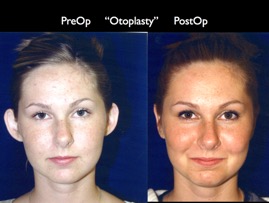 Cosmetic Patients.092.jpg