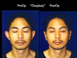 Cosmetic Patients.094.jpg