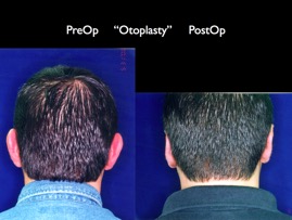 Cosmetic Patients.095.jpg