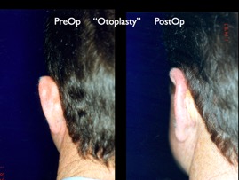 Cosmetic Patients.097.jpg
