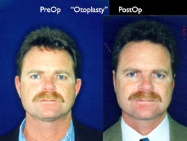 Cosmetic Patients.098.jpg