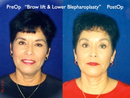 Cosmetic Patients.051.jpg