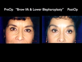 Cosmetic Patients.052.jpg