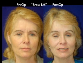 FacLift.001.jpg