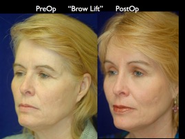 FacLift.002.jpg