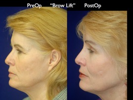 FacLift.003.jpg