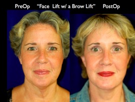 FacLift.032.jpg