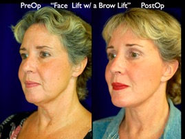 FacLift.033.jpg