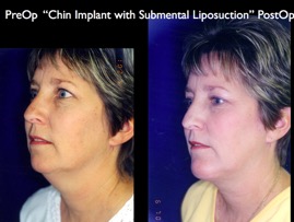 Cosmetic Patients.004.jpg