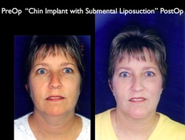 Cosmetic Patients.005.jpg