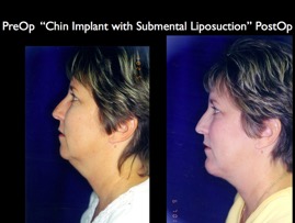 Cosmetic Patients.006.jpg