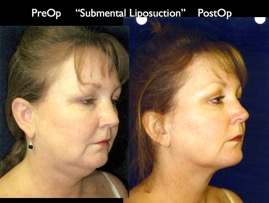 Cosmetic Patients.069.jpg