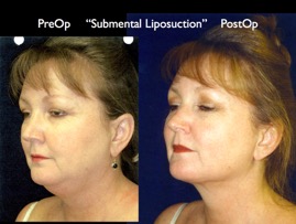Cosmetic Patients.070.jpg