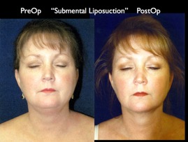 Cosmetic Patients.071.jpg