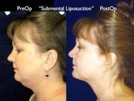 Cosmetic Patients.073.jpg