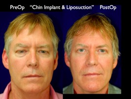 FacLift.004.jpg