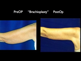 Brach.006.jpg