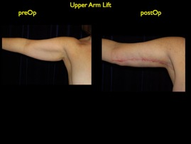 inner thigh.004.jpg