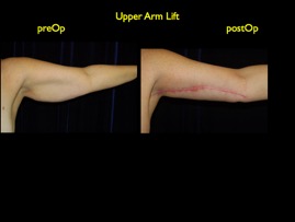 inner thigh.005.jpg