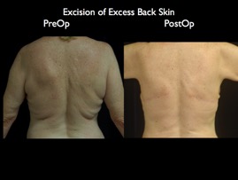 back-axilla.016.jpg