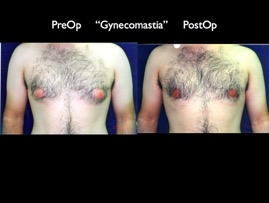 Cosmetic Patients.053.jpg