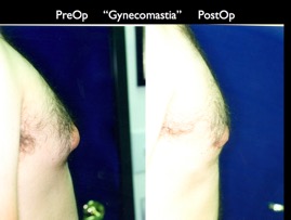 Cosmetic Patients.054.jpg