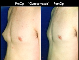 Cosmetic Patients.055.jpg