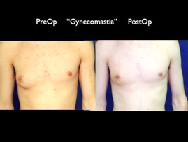 Cosmetic Patients.056.jpg