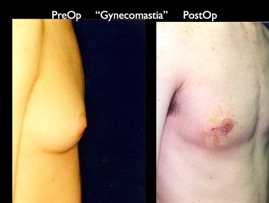 Cosmetic Patients.057.jpg