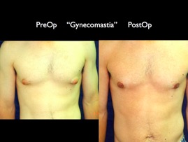 Cosmetic Patients.058.jpg