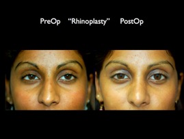 nose.001.jpg