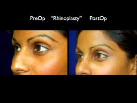 nose.002.jpg
