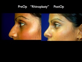 nose.003.jpg