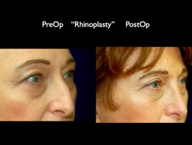 nose.004.jpg