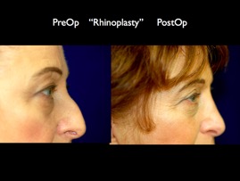 nose.005.jpg