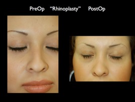 nose.006.jpg