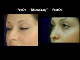 nose.007.jpg