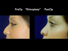 nose.008.jpg