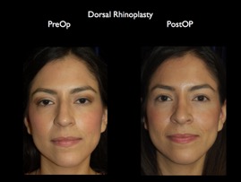 Nose.034.jpg