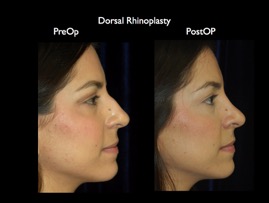 Nose.035.jpg
