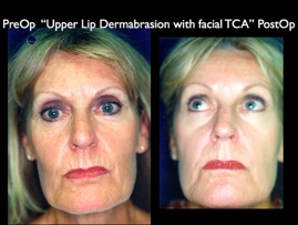 Cosmetic Patients.008.jpg