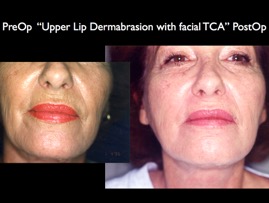 Cosmetic Patients.010.jpg
