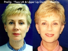 Cosmetic Patients.021.jpg