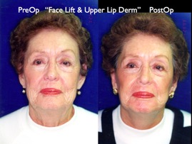 Cosmetic Patients.030.jpg