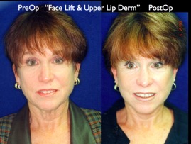Cosmetic Patients.033.jpg