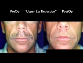 Cosmetic Patients.075.jpg