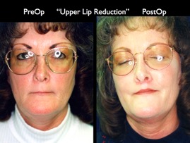 Cosmetic Patients.076.jpg