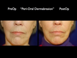 FacLift.009.jpg