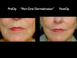FacLift.010.jpg