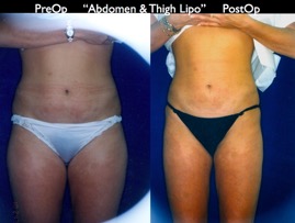 Cosmetic Patients.063.jpg